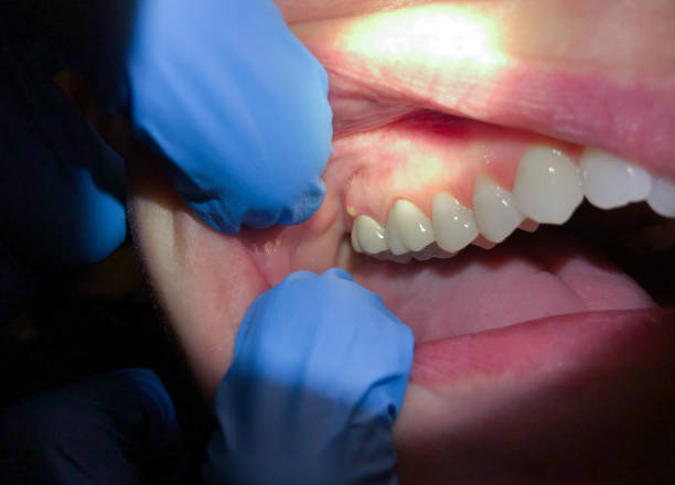 Best Emergency Dental Services for Seniors in Cincinnati, OH