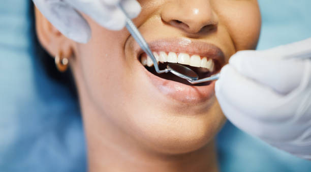 Best Broken or Cracked Tooth Emergency Dentist in Cincinnati, OH